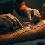 Innovación médica en Brasil con tratamiento de quemaduras usando piel de tilapia en soluciones sostenibles de salud pública.